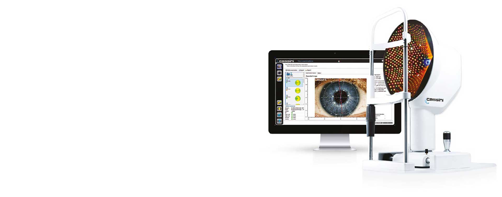 Cassini - True corneal shape analysis aids corrective eye surgeries